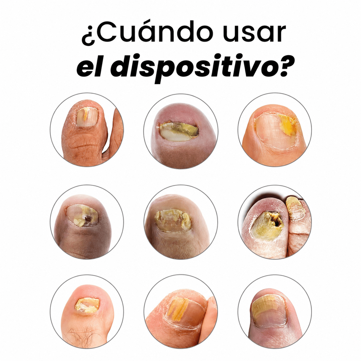 Dispositivo Láser Micoval
